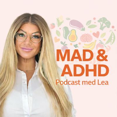 Mad og ADHD #2: Dopamin, ADHD og hvorfor mad kan føles så uimodståeligt