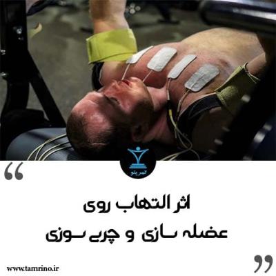 اثر التهاب روی عضله سازی و چربی سوزی (هوش مصنوعی)