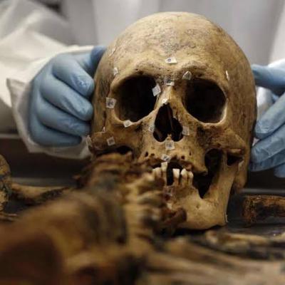 Aplicação dos métodos na identificação humana post mortem