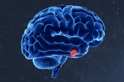 Seeing the Unseen: Early Recognition and Individualized Management of Acromegaly