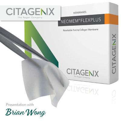 Neomem FlexPlus FAQs | Presentation with Brian Wong