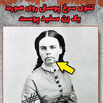 عکسی عجیب از دختری ۱۴ ساله!