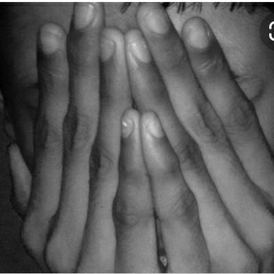 Healing Through Hypnosis: Sexual Abuse