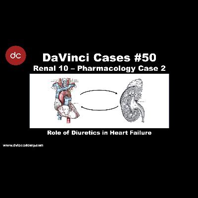 Role of Diuretics in Heart Failure [#DaVinciCases Renal 10 - Pharmacology Case 2]