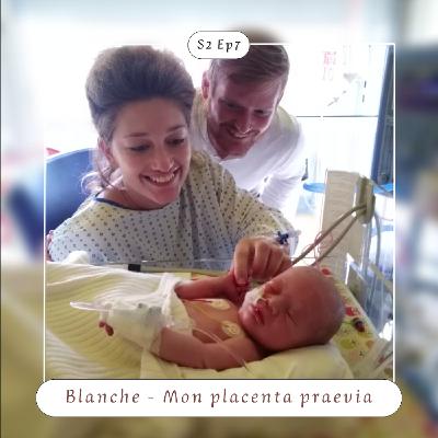 S2 Ep7 : Blanche - Mon Placenta Praevia