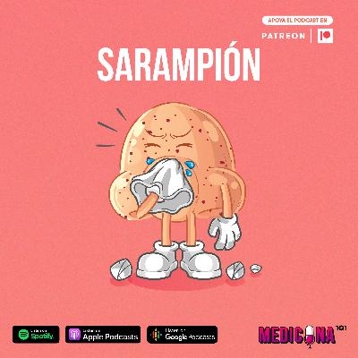 19. Sarampión