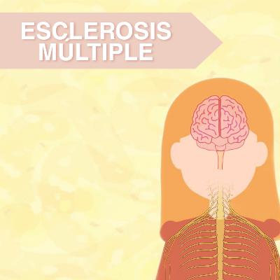 Todo lo que debes saber de Esclerosis Múltiple