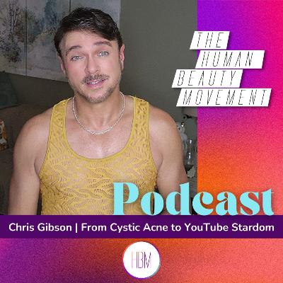 From Cystic Acne to YouTube Stardom with Chris Gibson, America’s Holistic Esthetician From Cystic Acne to YouTube Stardom with Chris Gibson, America’s Holistic Esthetician