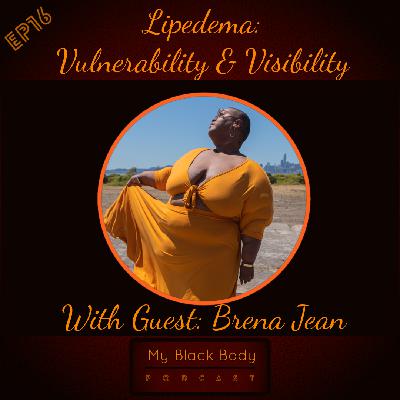 Lipedema:  Vulnerability  & Visibility Lipedema:  Vulnerability  & Visibility