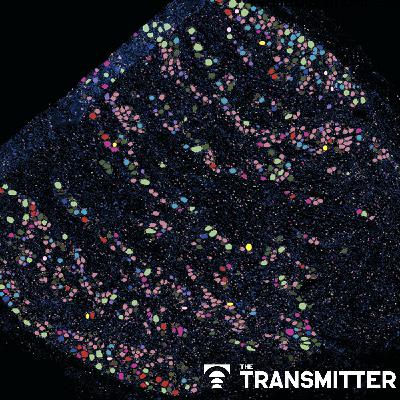 'Unprecedented' dorsal root ganglion atlas captures 22 types of human sensory neurons 'Unprecedented' dorsal root ganglion atlas captures 22 types of human sensory neurons