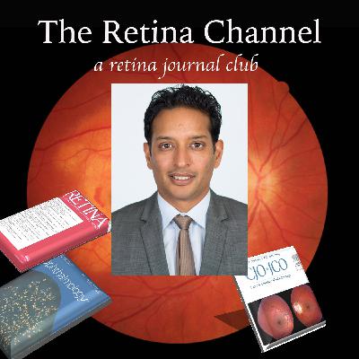 E84-Long-term Results of PIVOT and Suprachoroidal Viscopexy for RD Repair E84-Long-term Results of PIVOT and Suprachoroidal Viscopexy for RD Repair
