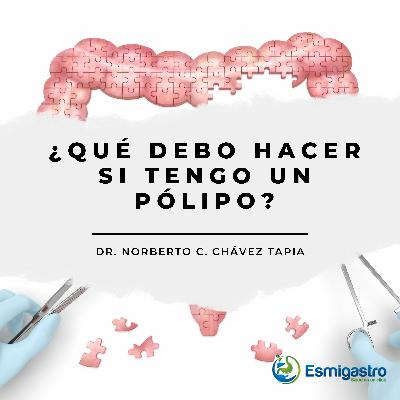 ¿Que Hacer Si Tengo Un Polipo?