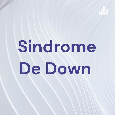 SIDROME DE DOWN