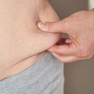 Studie: Adipositas sorgt für verschärfte Krankheitsverläufe