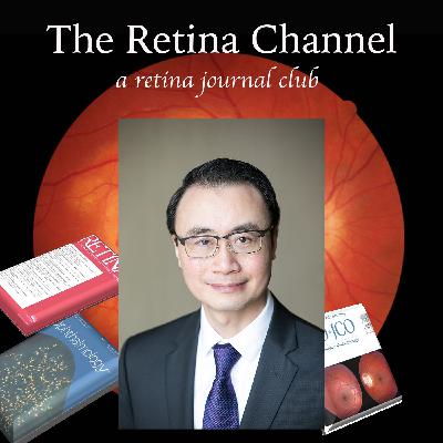 E78- Effect of Scleral Buckle on Outflow Facility, Intraocular Pressure, and Ocular Biomechanics- Dr. Arthur Sit E78- Effect of Scleral Buckle on Outflow Facility, Intraocular Pressure, and Ocular Biomechanics- Dr. Arthur Sit