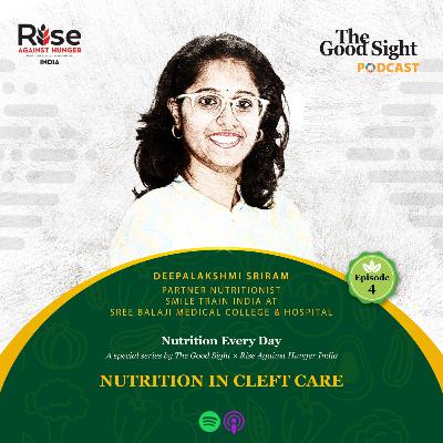 Nutrition in Cleft Care