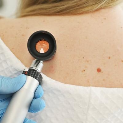 Skin pigmentation