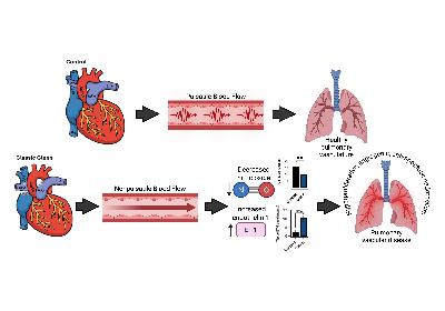 Interorgan Insights: Pulmonary Vascular Endothelial Cell Dysfunction Associated With the Nonpulsatile Pulmonary Blood Flow in an Ovine Glenn Model