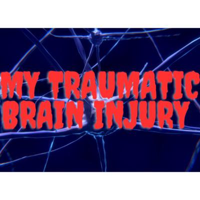 My Traumatic Brain Injury- Episode 7...The Final Chapter
