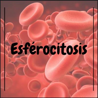 Esférocitosis