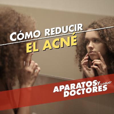 Cómo reducir el acné con tu dieta, y más
