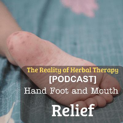 Hand, Foot & Mouth Relief: Herbal Hacks to Soothe Sores Fast