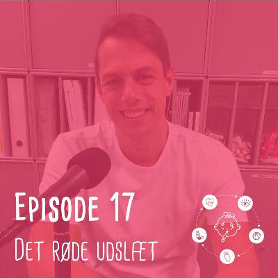 Trygge Forældre - #17 - Det røde udslæt