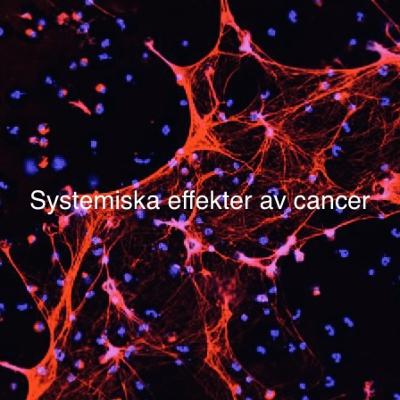 Systemiska effekter av cancer