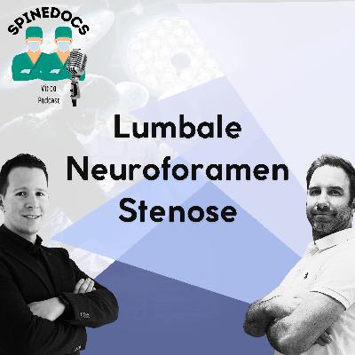Lumbale Neuroforamenstenose Lumbale Neuroforamenstenose