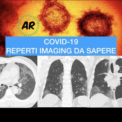COVID-19 Reperti imaging da sapere