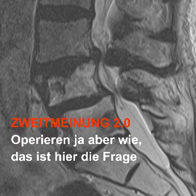 Zweitmeinung 2.0 - Operieren ja aber wie, das ist hier die Frage