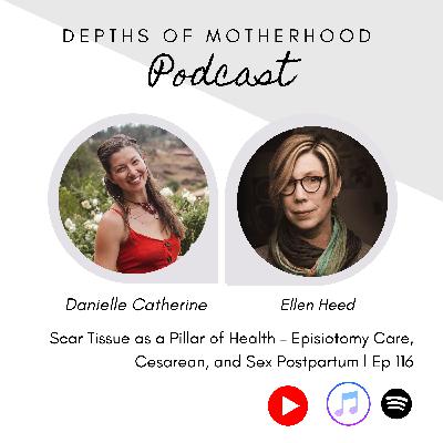 Scar Tissue as a Pillar of Health – Episiotomy Care, Cesarean, and Sex Postpartum with Ellen Heed l Ep 116