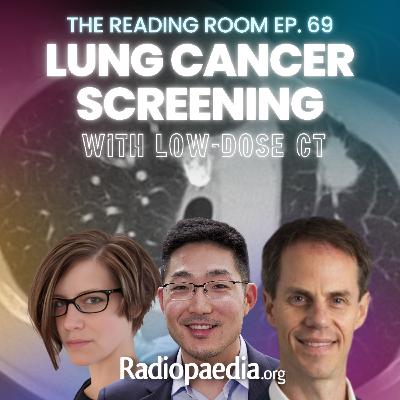 69. Lung cancer screening with low dose CT