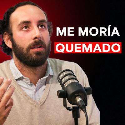 Me QUEMÉ Más del 60 % del CUERPO