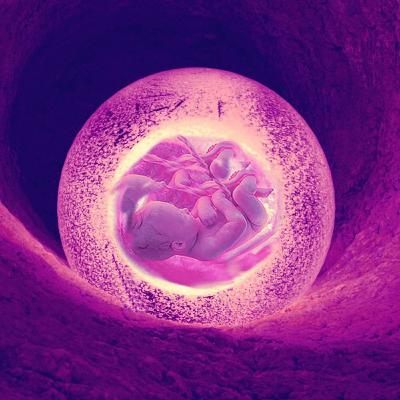 5. Sterilisaatio, varhainen ihmiselämä ja kohdunpoisto 5. Sterilisaatio, varhainen ihmiselämä ja kohdunpoisto