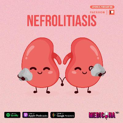 17. Nefrolitiasis