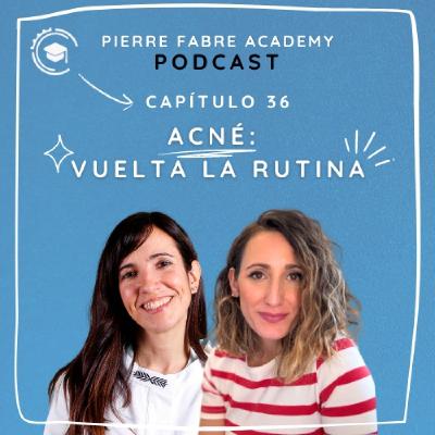 Acné: Vuelta a la rutina