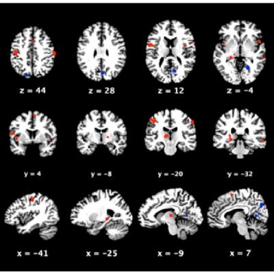 The Science of Voice-hearing