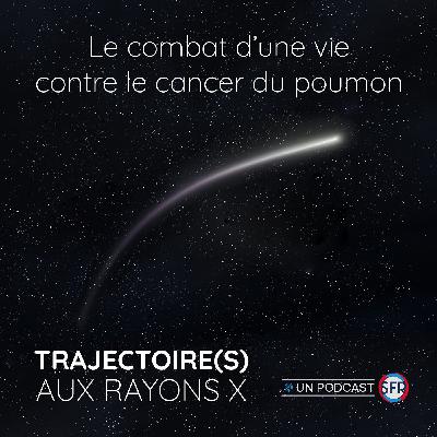 Pr. Marie-Pierre REVEL, le combat d’une vie contre le cancer du poumon Pr. Marie-Pierre REVEL, le combat d’une vie contre le cancer du poumon