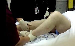 Hip Relocation Hip Relocation