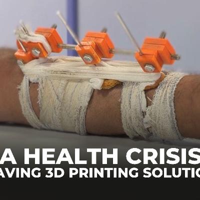 Gaza doctors use solar‑powered 3D printing to save limbs and lives Gaza doctors use solar‑powered 3D printing to save limbs and lives