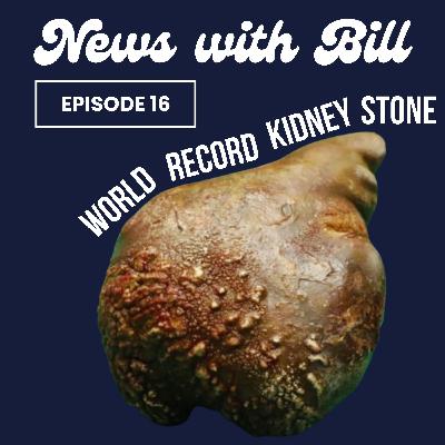 016: World Record Kidney Stone