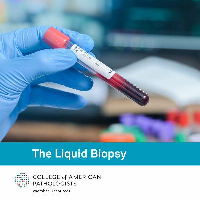 Applying Liquid Biopsies to Cancer Biomarkers in Circulating Tumors