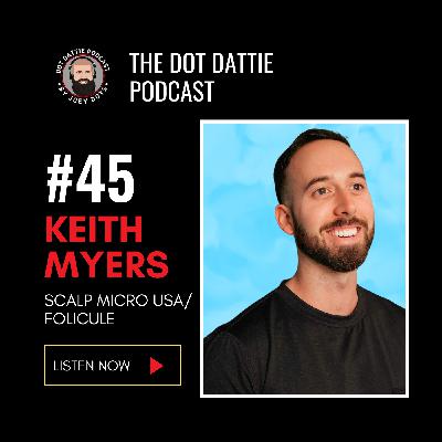 Dot Dattie Podcast #45 - Keith Myers - Scalp Micro USA/Folicule