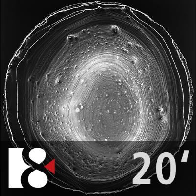 Křehkost a zranitelnost | Ve 20 minutách Křehkost a zranitelnost | Ve 20 minutách