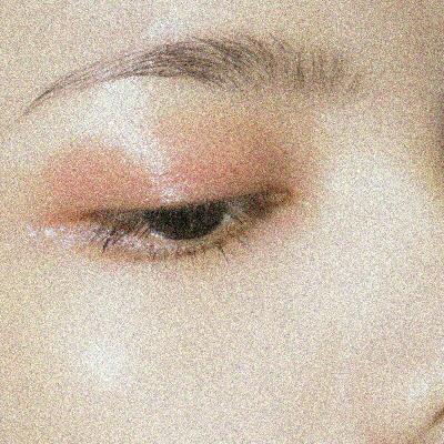 New innovative procedures for lower lid laxity & MGD plus new Vegan Super Protein better than whey?