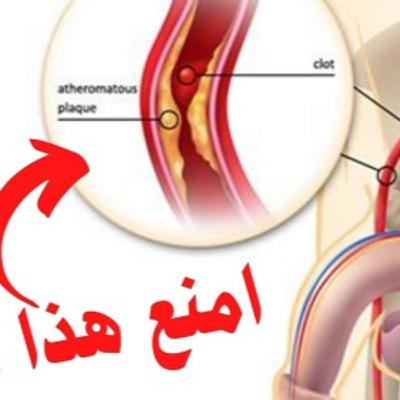 كيف تحافظ على صحة القضيب؟