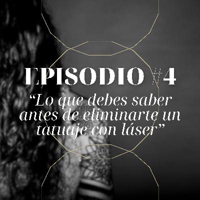 #4 Lo que debes saber antes de eliminarte un tatuaje con láser #4 Lo que debes saber antes de eliminarte un tatuaje con láser