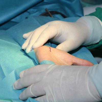 Ep. 28: Avoiding the Scalpel — Lessons from 57 Carpal Tunnel Surgeries So Far This Year