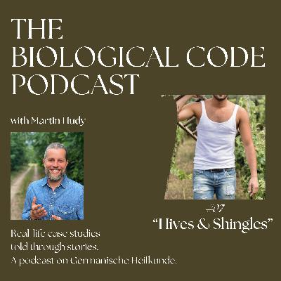 #7 - Hives and Shingles #7 - Hives and Shingles